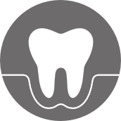 Περιοδοντολογία στον Άγιο Στέφανο - Prolipsis Dental
